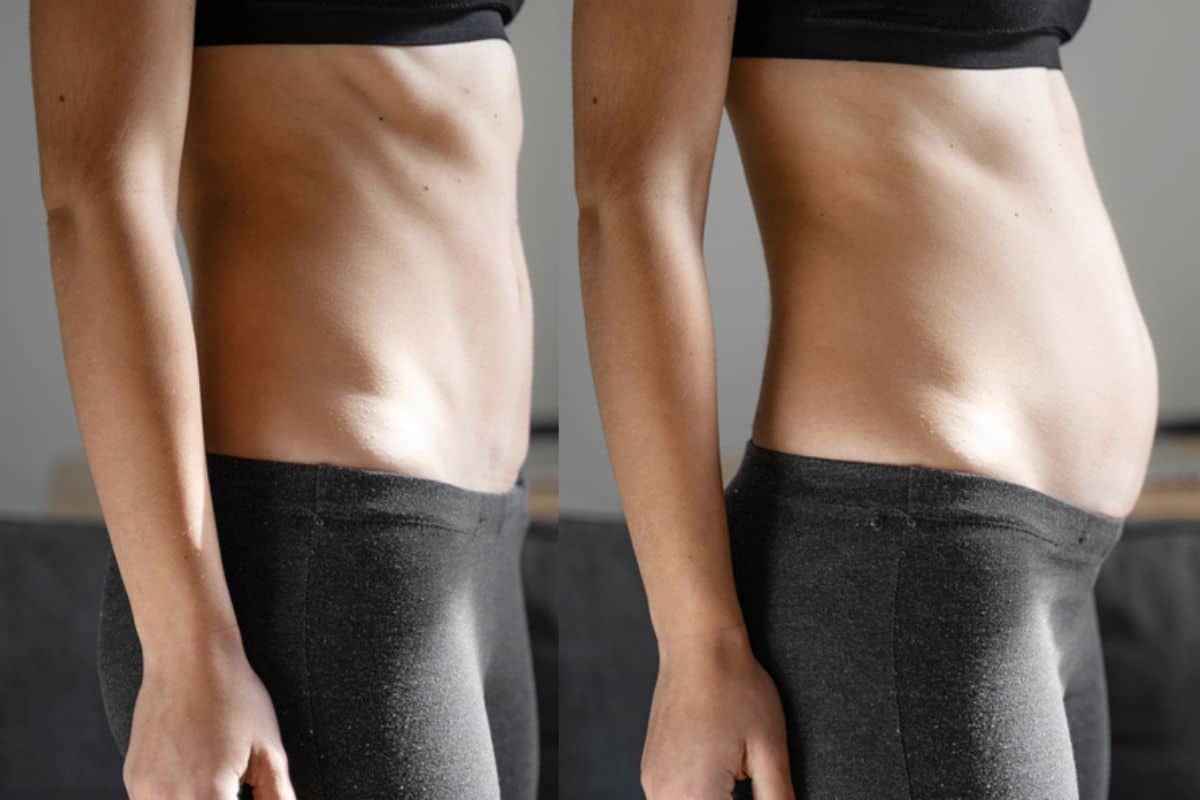 How long does diastasis recti take to improve Sands End?