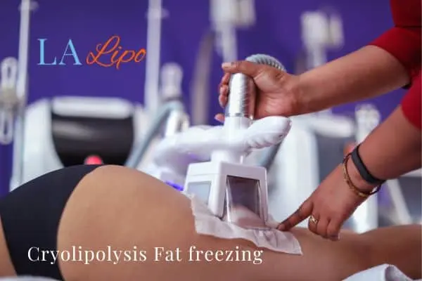 women getting fat freezing Sands End