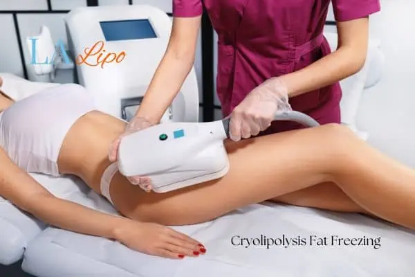 Woman receiving coolsculpting Sands End treatment on her thighs
