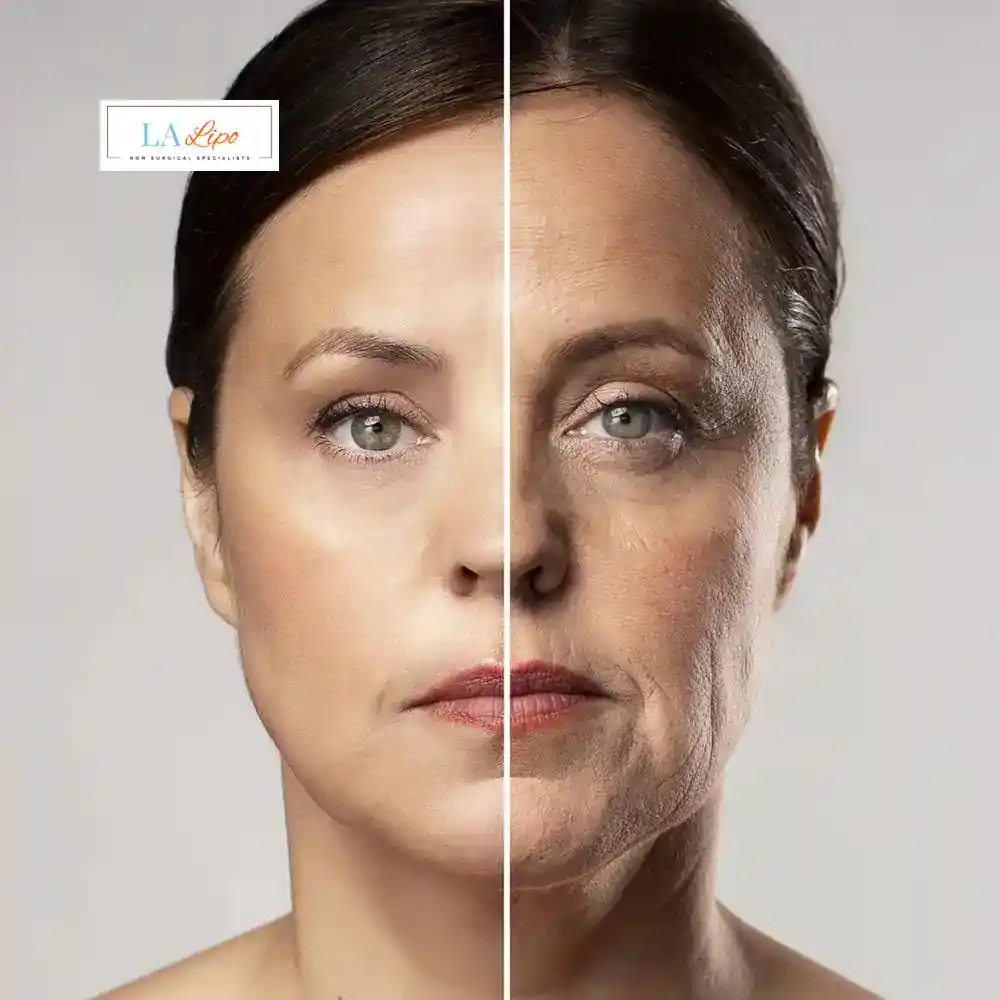 How Can You Tell If Non-Surgical Skin Tightening Is Right for You Sands End?