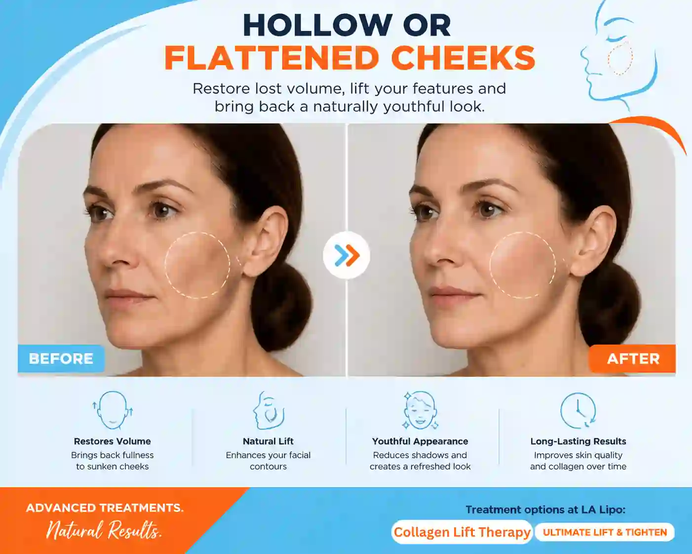 Sign #4: Hollow or Flattened Cheeks Sands End