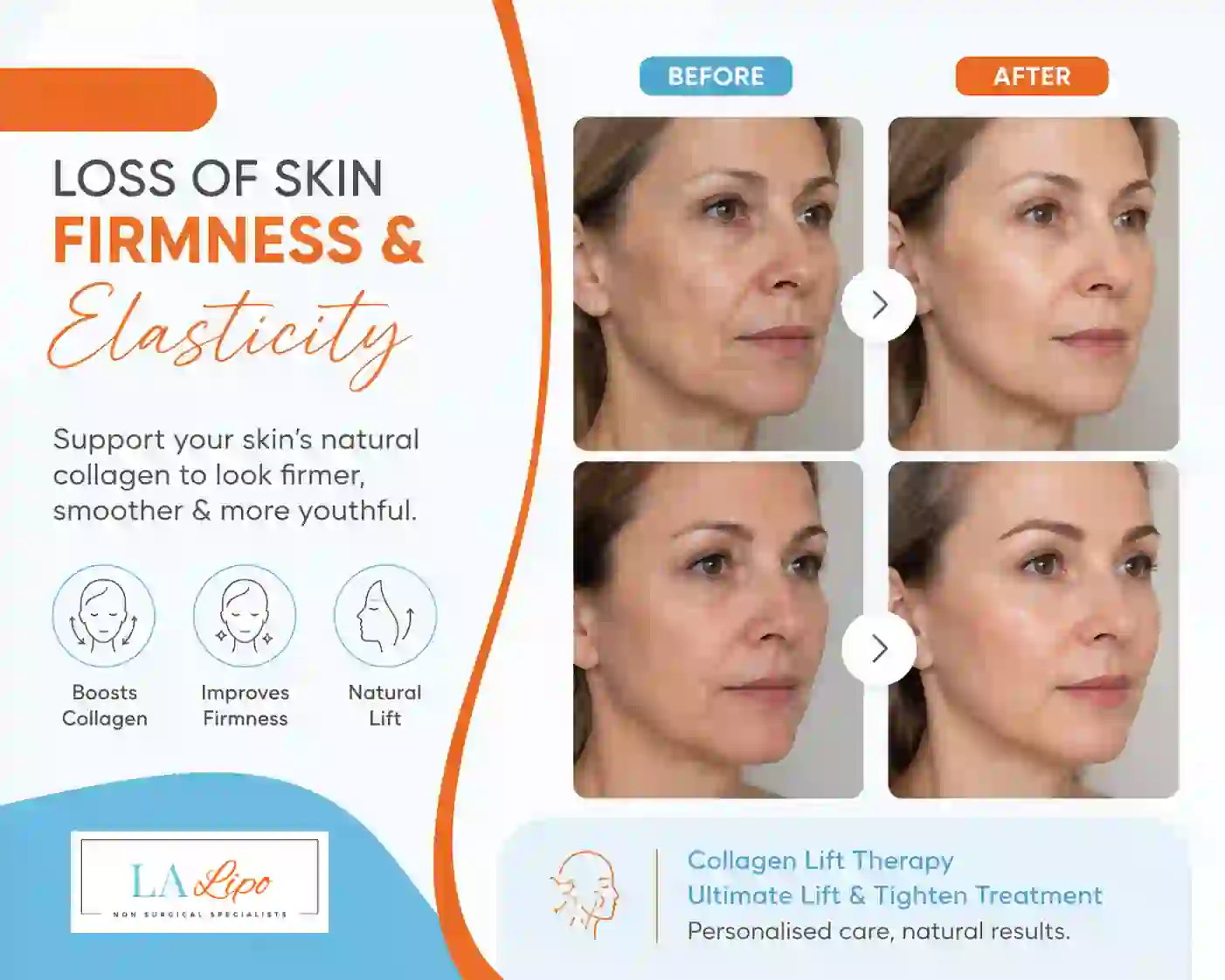 Sign #7: Loss of Skin Firmness and Elasticity Sands End