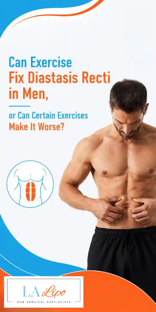 Can Exercise Fix Diastasis Recti in Men, or Can Certain Exercises Make It Worse Sands End?